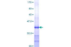 Image no. 1 for Cysteine-Rich, Angiogenic Inducer, 61 (CYR61) (AA 293-381) protein (GST tag) (ABIN1351029) (CYR61 Protein (AA 293-381) (GST tag))