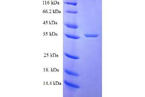 SDS-PAGE (SDS) image for Amyloid P Component, Serum (APCS) (AA 311-391) protein (GST tag) (ABIN5710163)