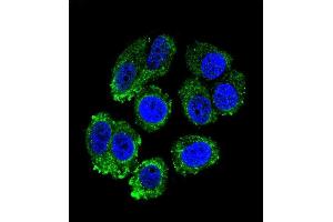 Confocal immunofluorescent analysis of RARS Antibody (C-term) (ABIN655043 and ABIN2844674) with MCF-7 cell followed by Alexa Fluor 488-conjugated goat anti-rabbit lgG (green).