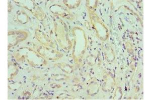 Immunohistochemistry of paraffin-embedded human kidney tissue using ABIN7151645 at dilution of 1:100 (SH3GLB1 antibody  (AA 1-365))