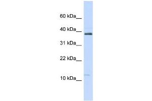 WB Suggested Anti-SPINK1 Antibody Titration:  0. (SPINK1 antibody  (N-Term))