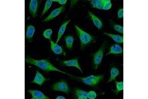 Immunofluorescence (IF) image for anti-Caspase 9, Apoptosis-Related Cysteine Peptidase (CASP9) antibody (ABIN7305084)