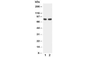 Western blot testing of FOXP1 antibody and Lane 1:  rat spleen (FOXP1 antibody  (C-Term))