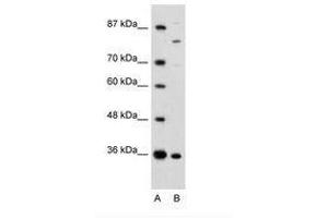 Image no. 1 for anti-Ankyrin Repeat and Zinc Finger Domain Containing 1 (ANKZF1) (AA 106-155) antibody (ABIN6735962) (ANKZF1 antibody  (AA 106-155))