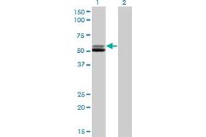 Western Blotting (WB) image for anti-Glutathione Reductase (GSR) (AA 413-523) antibody (ABIN598715) (Glutathione Reductase antibody  (AA 413-523))
