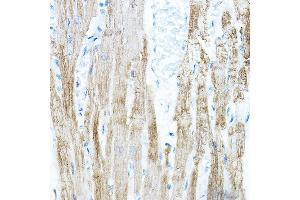 Immunohistochemistry of paraffin-embedded rat heart using PDK4 Rabbit pAb (ABIN6132477, ABIN6145396, ABIN6145397 and ABIN6217290) at dilution of 1:100 (40x lens). (PDK4 antibody  (AA 102-411))