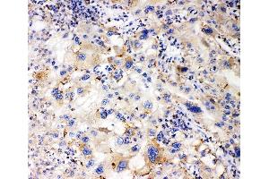IHC analysis of APOL1 using anti-APOL1 antibody (ABIN7600725). (APOL1 antibody  (AA 228-398))