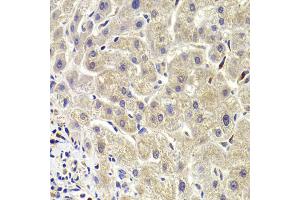 Immunohistochemistry of paraffin-embedded human liver injury using AKT1S1 Antibody (ABIN5973672) at dilution of 1/100 (40x lens).