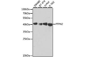 Western blot analysis of extracts of various cell lines, using PTPN2 antibody. (PTPN2 antibody)