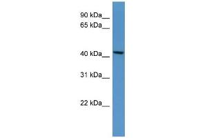WB Suggested Anti-B4galt5 Antibody Titration: 0. (B4GALT5 antibody  (C-Term))