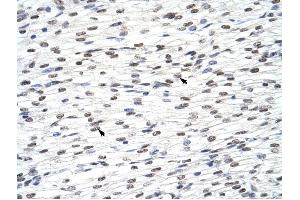 HNRPLL antibody was used for immunohistochemistry at a concentration of 4-8 ug/ml to stain Myocardial cells (arrows) in Human Heart. (HNRPLL antibody  (N-Term))