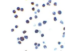 Immunohistochemistry (IHC) image for anti-BCL2-Antagonist/killer 1 (BAK1) (N-Term) antibody (ABIN1031258) (BAK1 antibody  (N-Term))