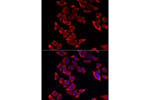 Immunofluorescence analysis of MCF-7 cell using RPL9 antibody. (RPL9 antibody)