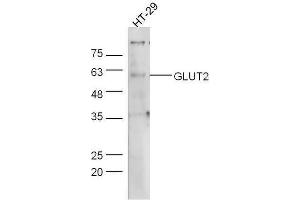 Human HT-29 lysates probed with Rabbit Anti-Glut2 Polyclonal Antibody, Unconjugated  at 1:5000 for 90 min at 37˚C. (SLC2A2 antibody  (AA 482-524))