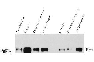 Western Blot analysis of various samples using MAP2 Polyclonal Antibody at dilution of 1:1000. (MAP2 antibody)