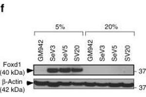 MICU1 is transcriptionally regulated by Foxd1 under hypoxia. (FOXD1 antibody  (C-Term))