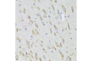 Immunohistochemistry of paraffin-embedded mouse brain using RPL13 Antibody. (RPL13 antibody  (AA 1-211))