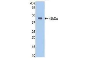 Detection of Recombinant JAG1, Human using Polyclonal Antibody to Jagged 1 (JAG1) (JAG1 antibody  (AA 470-834))