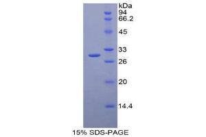 SDS-PAGE (SDS) image for Glutathione S-Transferase mu 2 (Muscle) (GSTM2) (AA 3-218) protein (His tag) (ABIN2125010)