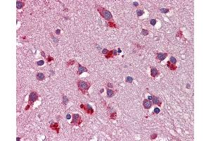 Immunohistochemistry (IHC) image for anti-Wingless-Type MMTV Integration Site Family, Member 7B (WNT7B) (Middle Region) antibody (ABIN2776732) (WNT7B antibody  (Middle Region))