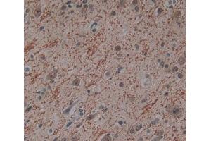 Used in DAB staining on fromalin fixed paraffin- embedded Kidney tissue (PITPNB antibody  (AA 2-271))