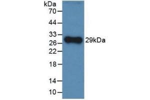 Western Blot; Sample: Recombinant CFH, Rat. (Complement Factor H antibody  (AA 975-1217))