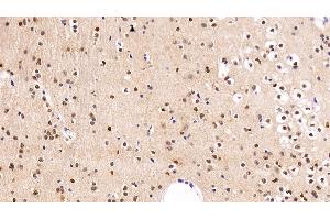 Immunohistochemistry (IHC) image for anti-Fibroblast Growth Factor 2 (Basic) (FGF2) (AA 159-288) antibody (ABIN7431986)