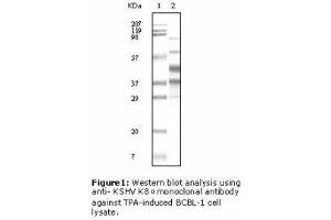 Image no. 2 for anti-KSHV K8 alpha antibody (ABIN478368) (KSHV K8 alpha antibody)