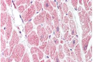 Human Heart (formalin-fixed, paraffin-embedded) stained with PTGIS antibody ABIN214080 at 20 ug/ml followed by biotinylated goat anti-rabbit IgG secondary antibody ABIN481713, alkaline phosphatase-streptavidin and chromogen. (PTGIS antibody  (AA 475-490))