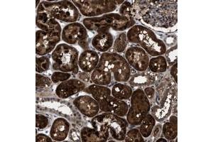 Immunohistochemical staining of human kidney with C9orf9 polyclonal antibody  shows strong cytoplasmic positivity in tubular cells. (C9orf9 antibody)