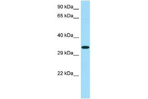 WB Suggested Anti-RBFA Antibody Titration: 1. (RBFA antibody  (C-Term))