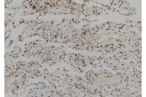 ABIN6273708 at 1/100 staining Human lung tissue by IHC-P. (SYCP2 antibody  (Internal Region))