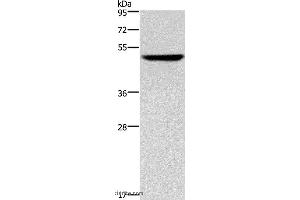 Western blot analysis of Hela cell, using KRT16 Polyclonal Antibody at dilution of 1:350 (KRT16 antibody)