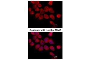 ICC/IF Image Immunofluorescence analysis of paraformaldehyde-fixed A431, using Transketolase, antibody at 1:500 dilution. (TKT antibody)