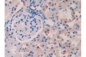 Used in DAB staining on fromalin fixed paraffin- embedded stomach tissue (PIGR antibody  (AA 343-447))