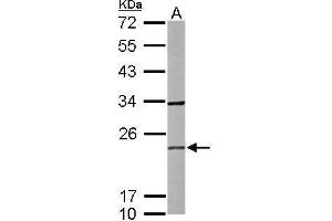 WB Image Sample (50 ug of whole cell lysate) A: mouse brain 12% SDS PAGE antibody diluted at 1:1000 (RAB2B antibody)