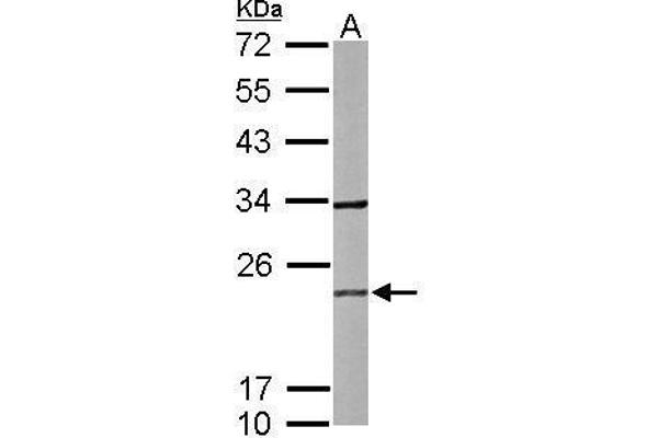 RAB2B antibody