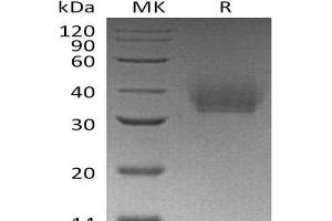 Western Blotting (WB) image for Interleukin 21 Receptor (IL21R) protein (His tag) (ABIN7320813) (IL21 Receptor Protein (His tag))