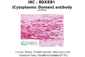 Image no. 1 for anti-Bradykinin Receptor B1 (BDKRB1) (1st Cytoplasmic Domain) antibody (ABIN1732268)
