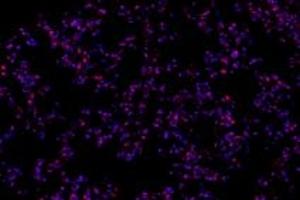 Immunofluorescent analysis of paraformaldehyde-fixed mouse lung using,RPAP2 (ABIN7075481) at dilution of 1: 1000 (RPAP2 antibody)