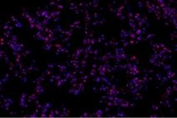 RPAP2 antibody
