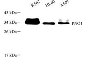Western blot analysis of PNO1 (ABIN7074991),at dilution of 1: 1000 (PNO1 antibody)
