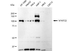 Western blotting analysis using NFATC2 antibody (ABIN7799637).