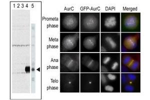 The anti-Aurora C Pab (ABIN1882164 and ABIN2841162) is used in Western blot to detect Aurora C in lysates of 293 cells expressing Flag tag (lane 1), Flag-tagged Aurora A (lane 2), Flag-tagged Aurora B (lane 3), Flag-tagged Aurora C (lane 4), and in  cell lysate. (Aurora Kinase C antibody  (N-Term))