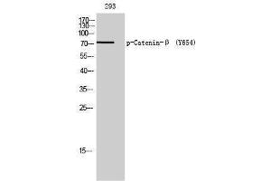 Western Blotting (WB) image for anti-Catenin, beta (CATNB) (pTyr654) antibody (ABIN3181948) (beta Catenin antibody  (pTyr654))