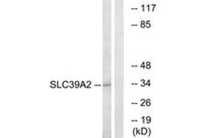 Western blot analysis of extracts from Jurkat cells, using SLC39A2 Antibody. (ZIP2 antibody  (AA 11-60))
