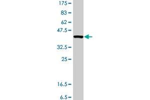 Western Blot detection against Immunogen (37 KDa) . (MYT1 antibody  (AA 586-685))