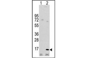 Western blot analysis of LC3 (APG8a) (arrow) using Autophagy LC3 Antibody (APG8a) (D106) Cat. (MAP1LC3A antibody  (AA 92-121))