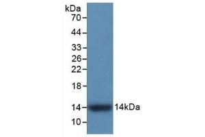 Detection of Recombinant S100A9, Human using Monoclonal Antibody to S100 Calcium Binding Protein A9 (S100A9) (S100A9 antibody  (AA 1-114))