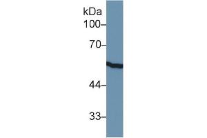 Western Blot; Sample: Rat Small intestine lysate; Primary Ab: 1µg/ml Rabbit Anti-Rat KRT8 Antibody Second Ab: 0. (KRT8 antibody  (AA 399-483))